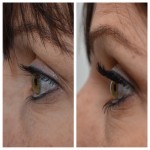 Wimpernverlängerung / Verdichtung