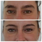 Lidstrich oben und unten